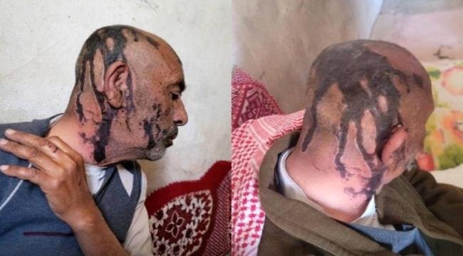 اعتداء عنصرين من مليشيا الحوثي على والدهما المسن في محافظة عمران اليمنية اعتداء عنصرين من مليشيا الحوثي على والدهما المسن في محافظة