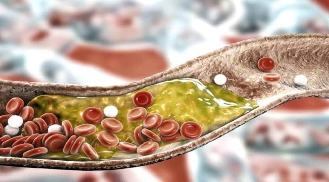 تعرف على أطعمة تخفض الكوليسترول خلال أسابيع تعرف على أطعمة تخفض الكوليسترول خلال أسابيع