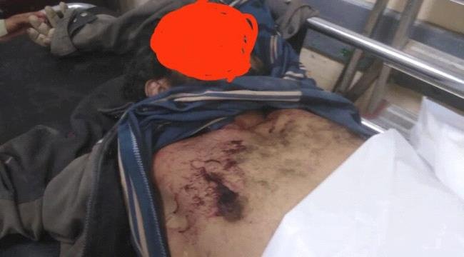 مقتل عامل برصاص قيادي حوثي في صعدة اليمنية مقتل عامل برصاص قيادي حوثي في صعدة اليمنية