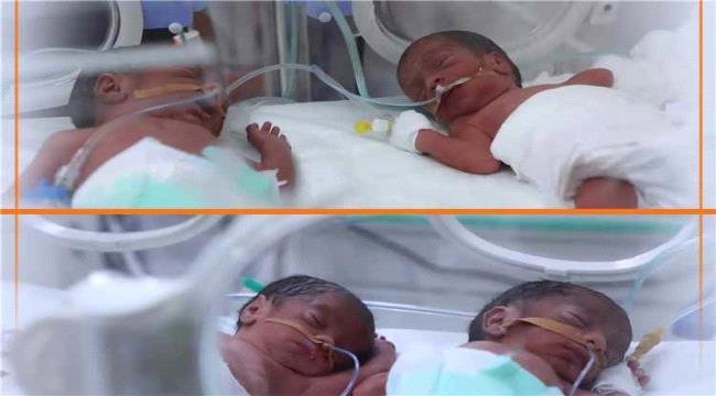 ولادة نادرة لأربعة توائم في مأرب اليمنية والأم والمواليد بصحة جيدة ولادة نادرة لأربعة توائم في مأرب اليمنية والأم والمواليد بصحة