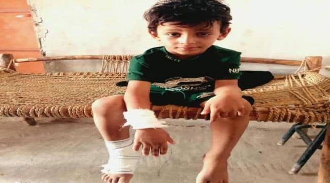 إصابة طفل بقصف حوثي استهدف منزلًا جنوب الحديدة اليمنية إصابة طفل بقصف حوثي استهدف منزلًا جنوب الحديدة اليمنية