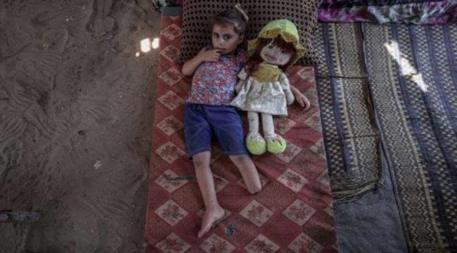 صحة غزة: 5 آلاف حالة بتر و10 آلاف بحاجة لتأهيل طويل الأمد صحة غزة 5 آلاف حالة بتر و10 آلاف بحاجة لتأهيل